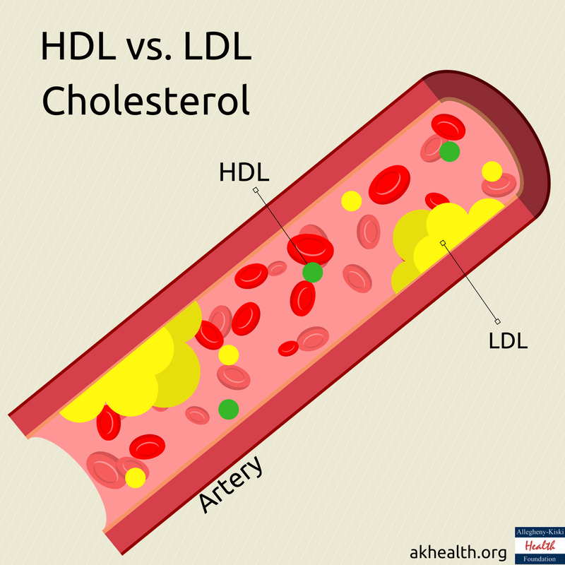 Whats The Difference Between “good” And “bad” Cholesterol And How To Balance Them 8707